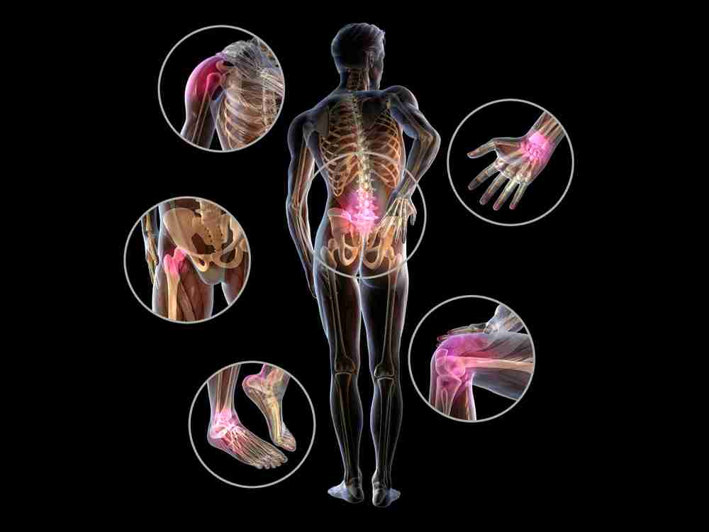 3d,Illustration,Showing,Painful,Joints,Of,A,Man,,Rheumatoid,Arthritis Illustration of a human skeleton with pain highlighted at the shoulder, wrist, lower back, hip, knee and ankle